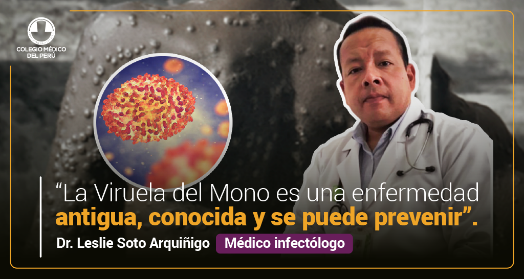 ¿QUÉ ES LA VIRUELA DEL MONO? Colegio Médico del Perú Consejo Nacional